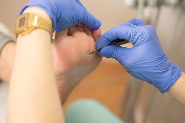 Gemma realitzant un tractament de podologia a domicili